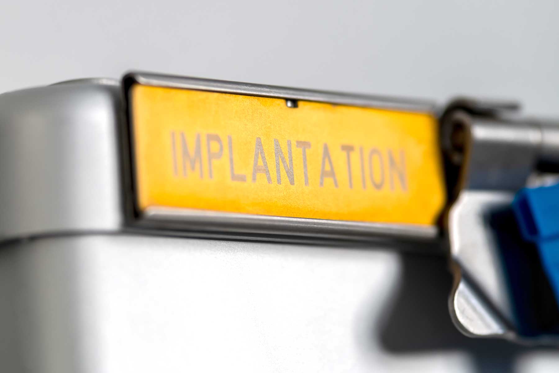 Digitale Implantologie